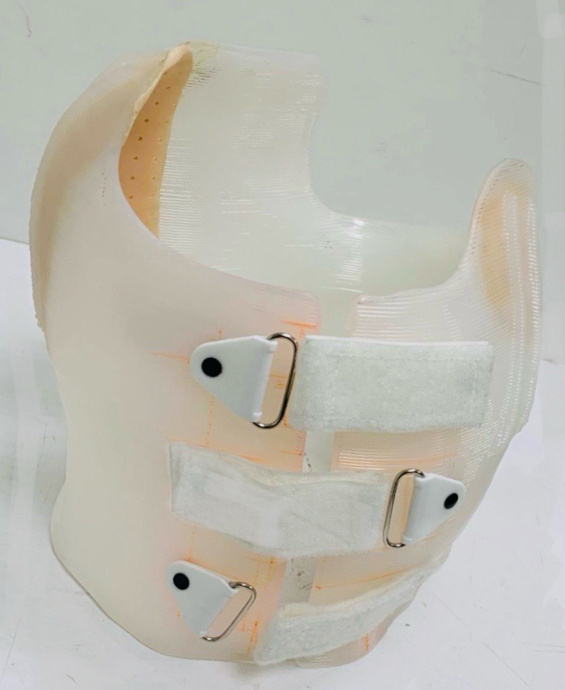 Индивидуальный ортопедический корсет 3D печать