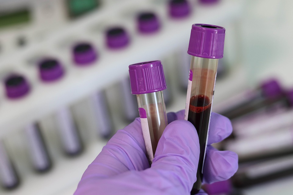 Мониторинг состояния крови при онкологии